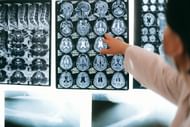 Forensic reports revealed that the victims were strangled with a ligature (Image via Pexels)